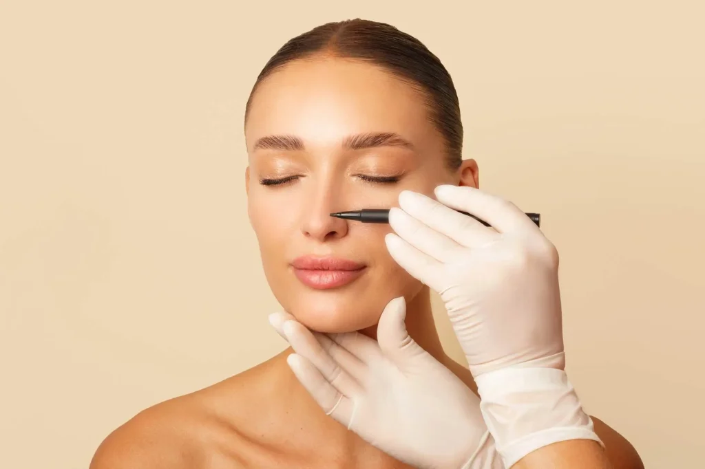 Ρινοπλαστική