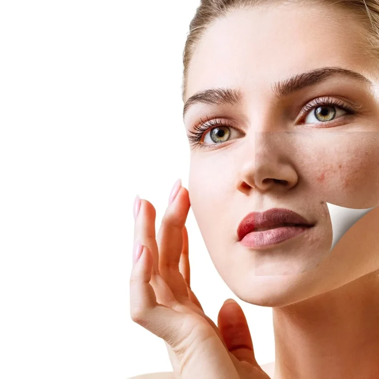 laser-gia-evryaggeies-1